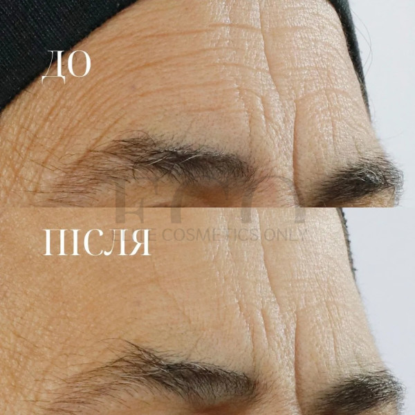Сироватка із потрійним ретинолом Perricone MD High Potency Triple Retinol Renewal Serum, 59 мл